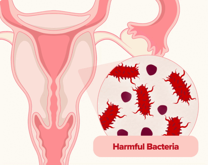 biological diagram of harmful bacterias impact on the vaginal microbiome
