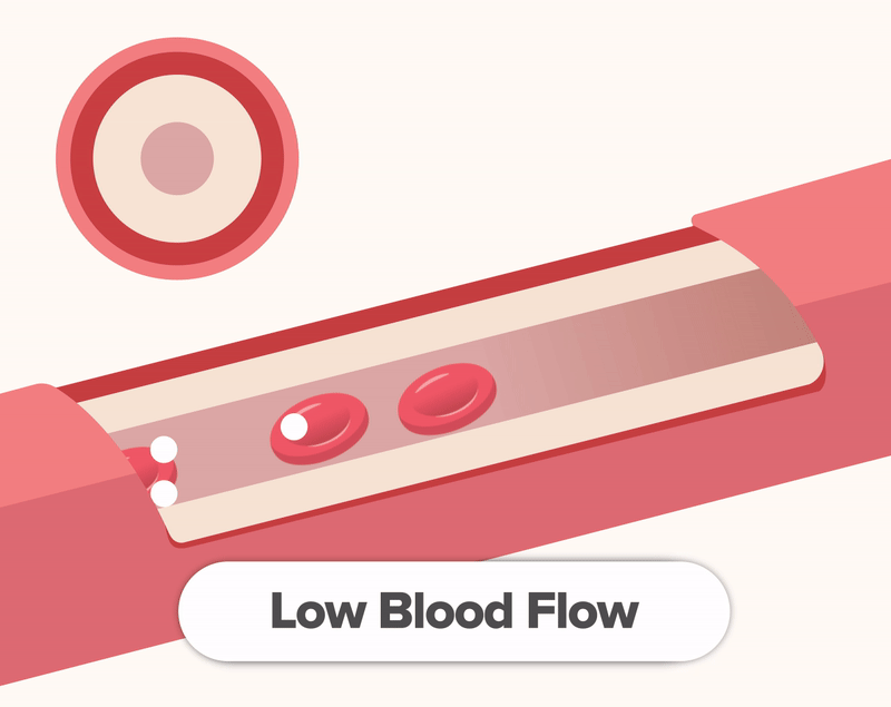 Aging & Blood Flow