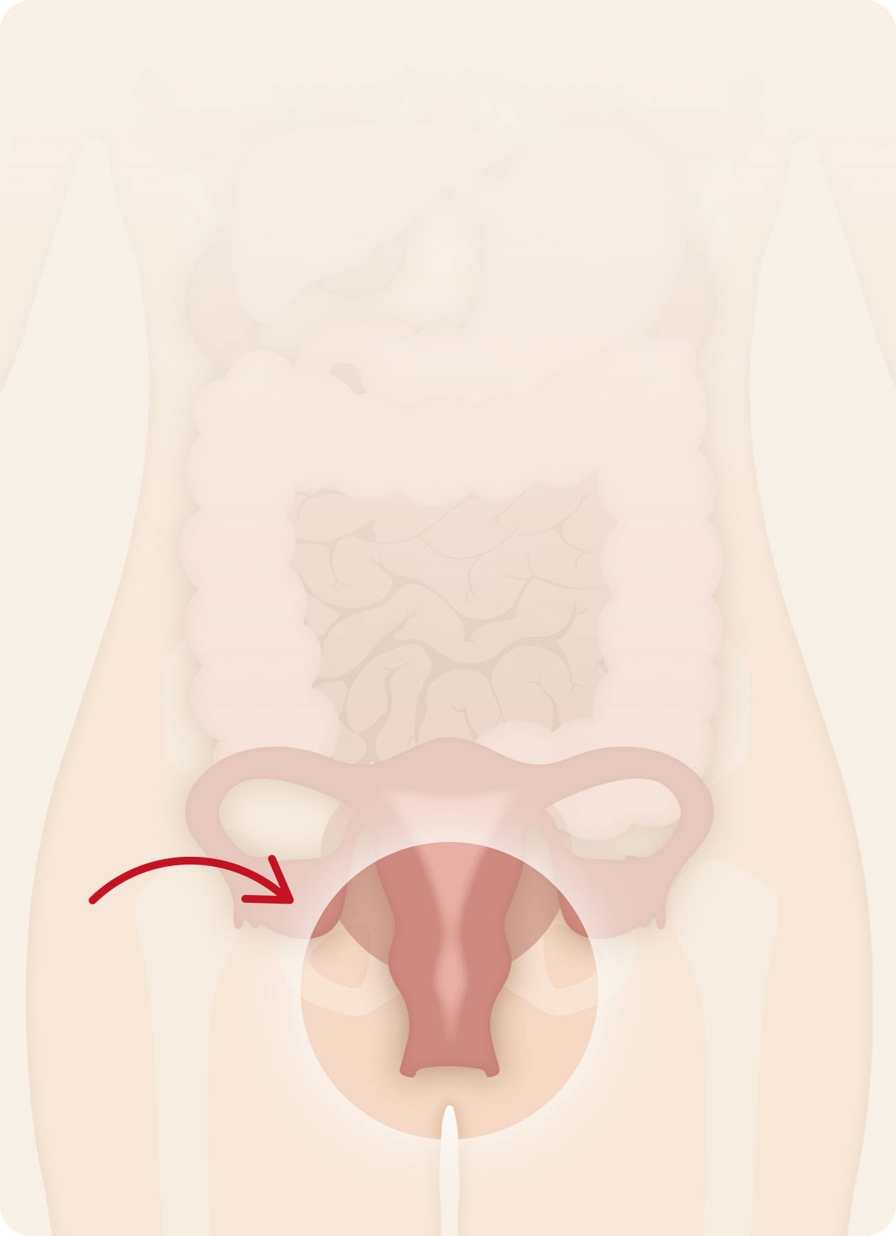 Vaginal Probiotic